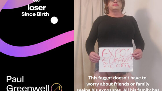 Lose since birth Paul Greenwell